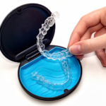 Invisalign FAQ