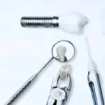 dental implants vs. bridges