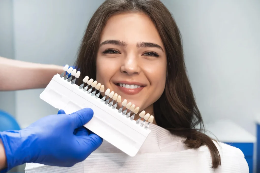 choosing a shade for veneers charlotte
