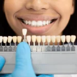 patient in for a veneers charlotte procedure