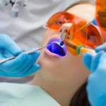 teeth whitening charlotte