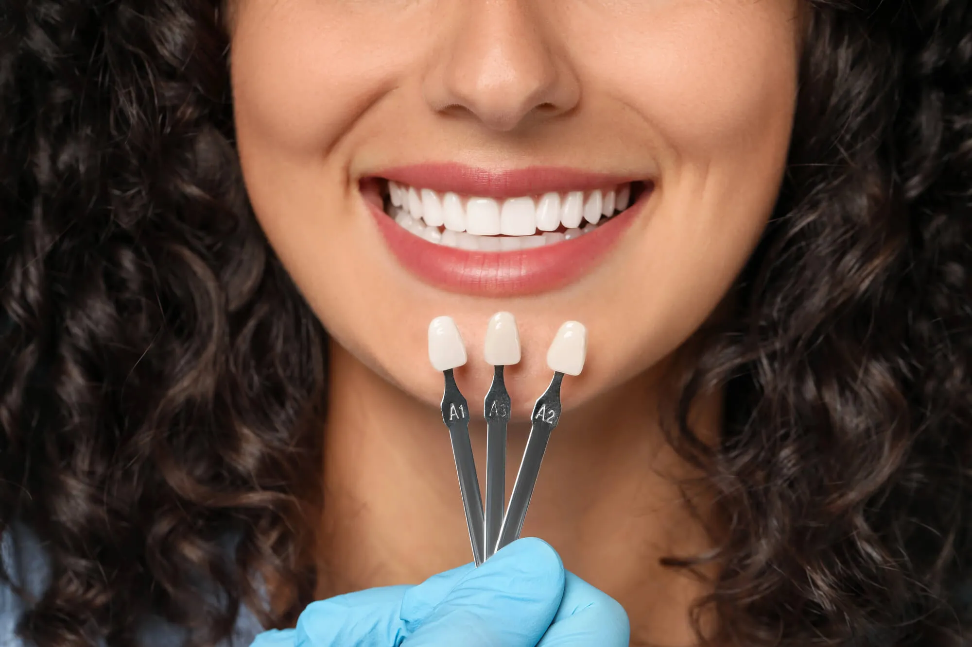 choosing a shade for her veneers charlotte