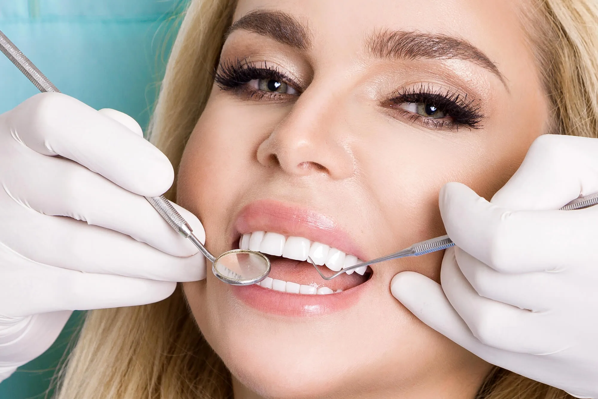 woman getting her new veneers charlotte