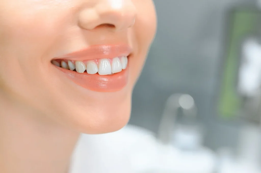 after-teeth-whitening-charlotte