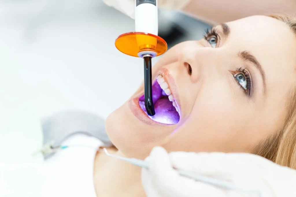 during-teeth-whitening-charlotte
