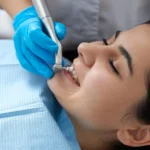 professional-dental-cleaning-charlotte